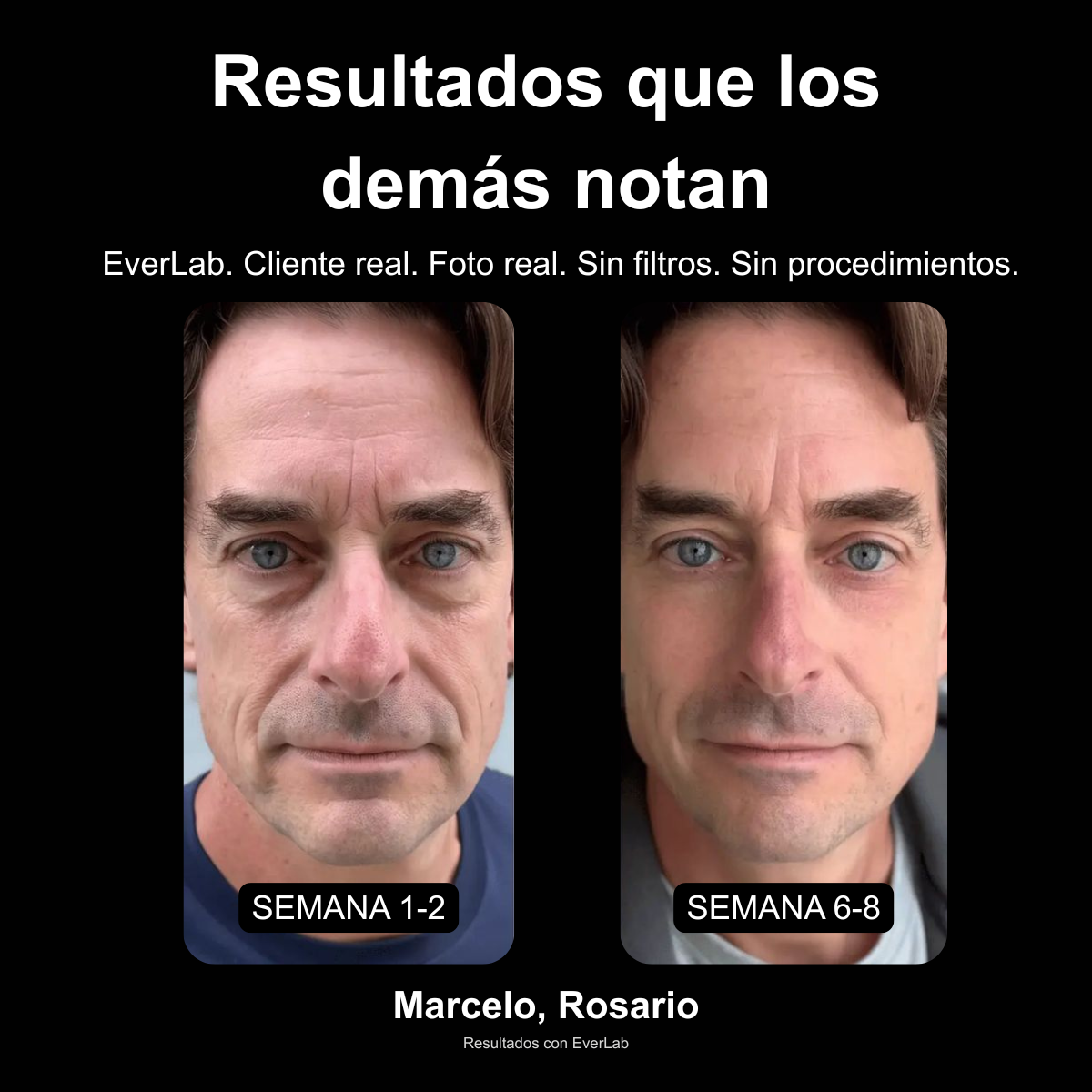 ROLL-ON ANTIAGE PARA CONTORNO DE OJOS